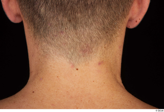 Arnost neck 0006.jpg